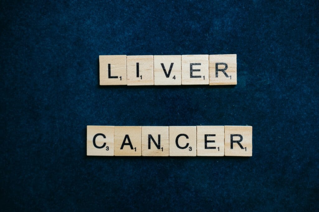 Cancer and Alcohol: Exploring the Risk Connection in 2025 Cancer Liver cancer